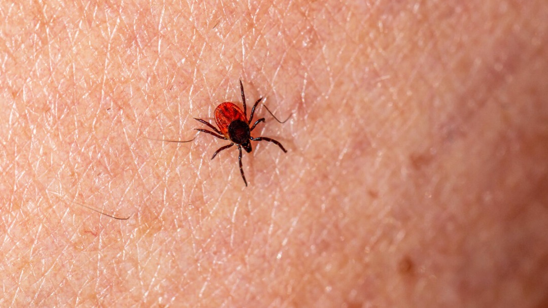 تسجيل إصابات بمرض الركيتسيا في المنطقة الوسطى