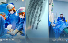 جهود نوعية للأطقم الطبية بمستشفى وادي البوانيس 