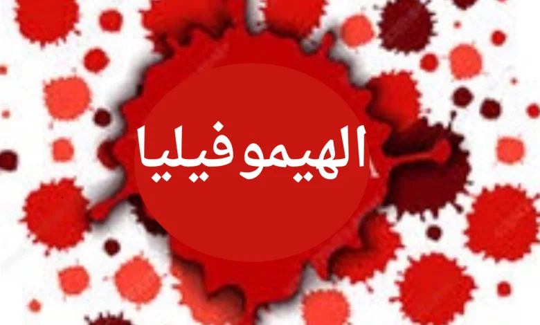 مرضى الهيموفيليا في ليبيا يطالبون بتوفير عيادات متخصصة لعلاجهم