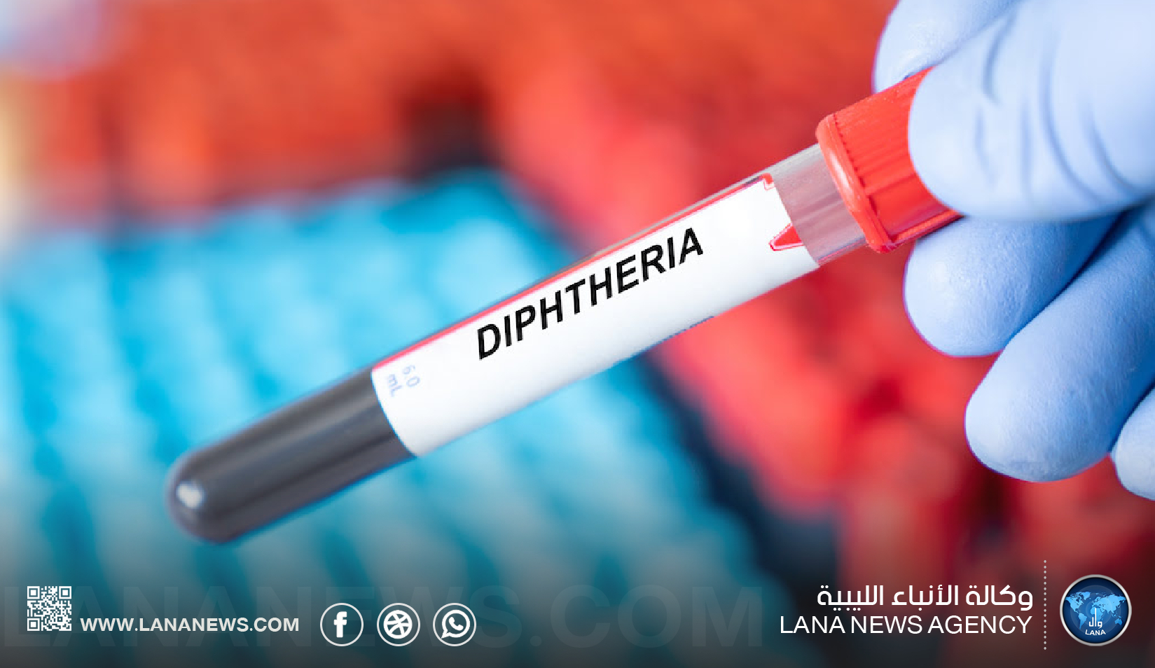 موريتانيا: حالتا وفاة و53 إصابة بالدفتيريا