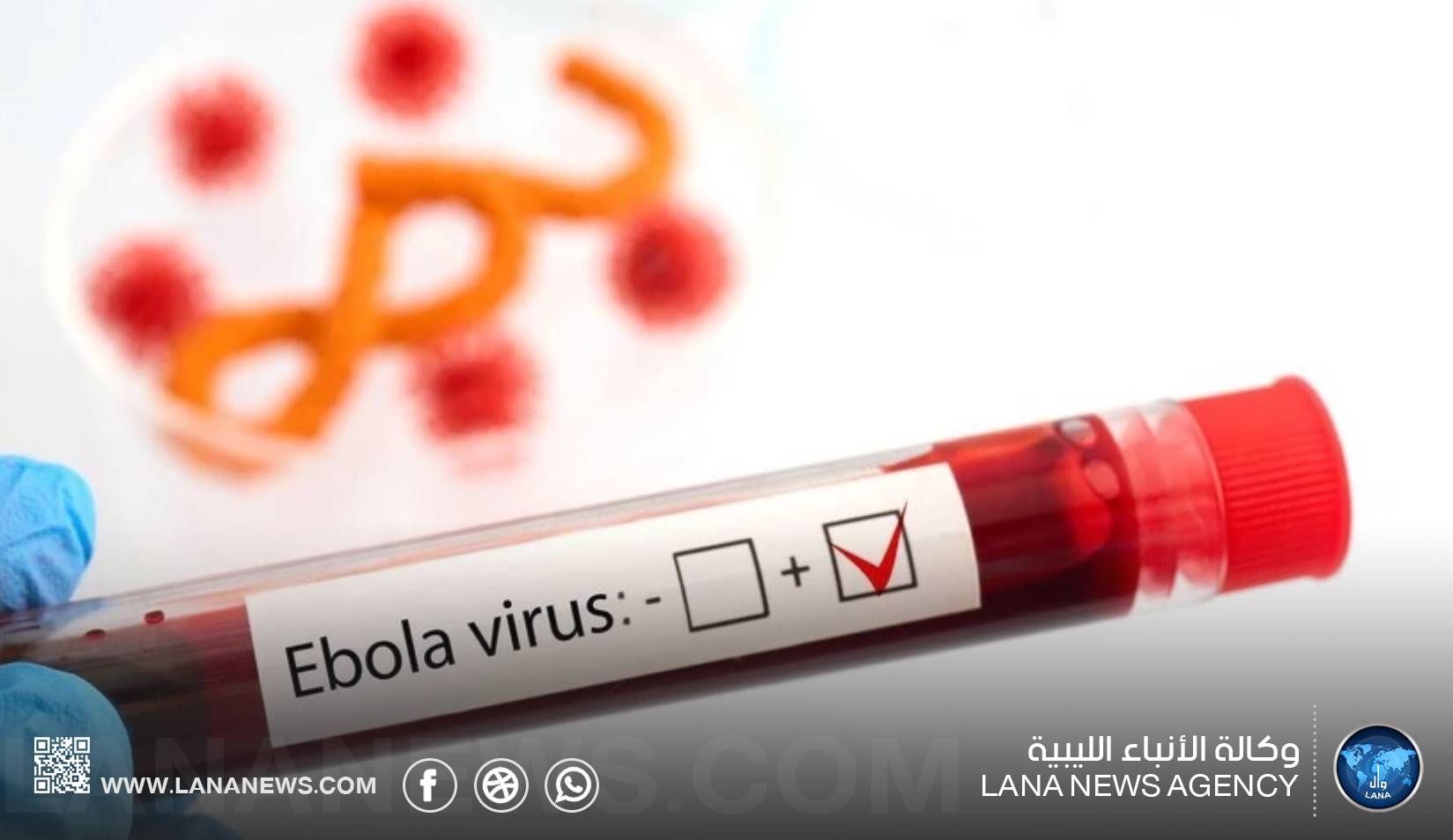 السفارة الليبية بأوغندا تحذر الجالية من مخاطر فيروس إيبولا