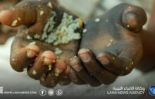 تراجع معدلات الجوع عالميا للعام الثالث على التوالي