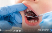 تسوس الأسنان المبكر لدى الأطفال.. أسباب متعددة ودعوات لتعزيز الوقاية