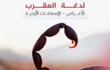 مركز مكافحة الأمراض يحذر من تزايد لدغات العقارب خلال الصيف