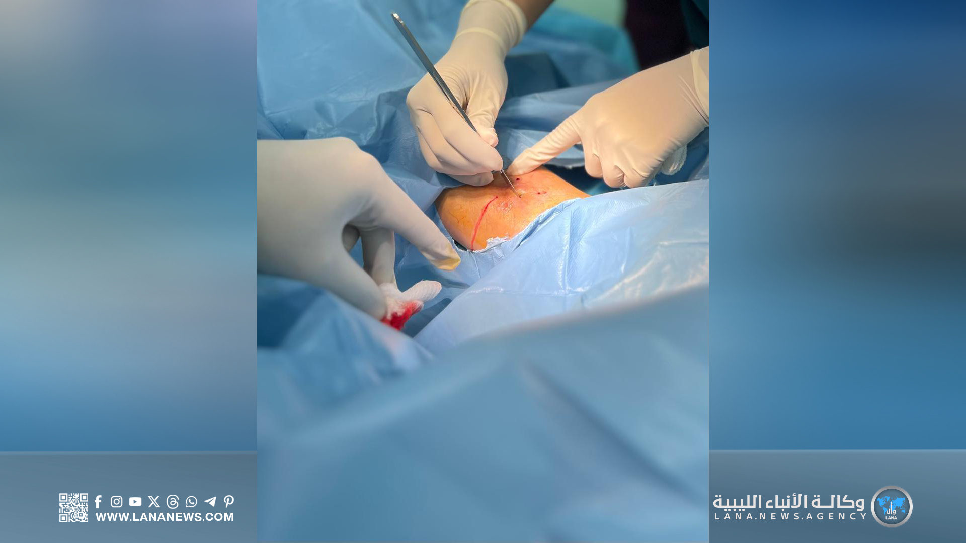 نجاح العمليات الجراحية الصغرى في العيادة المجمعة خالد بن الوليد