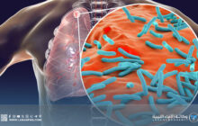 علماء يحددون البكتيريا المسؤولة عن أول جائحة في التاريخ