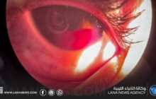 تزايد حالات إصابة الأطفال بألعاب خطرة في أجدابيا