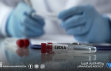 الوطني لمكافحة الأمراض يؤكد عدم تسجيل إصابات بالإيبولا