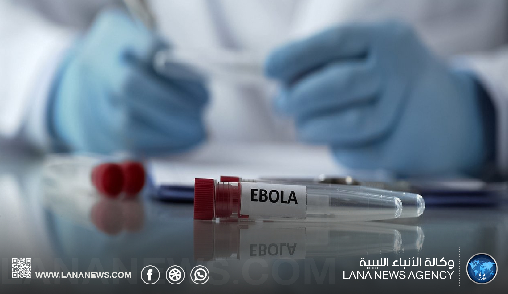الوطني لمكافحة الأمراض يؤكد عدم تسجيل إصابات بالإيبولا