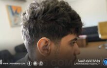 التضامن الاجتماعي يواصل توفير المعينات السمعية للمستفيدين من خدماته