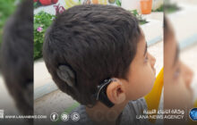 زراعة القوقعة في ليبيا.. خبرات محلية تعزز فرص التأهيل والدمج للأطفال