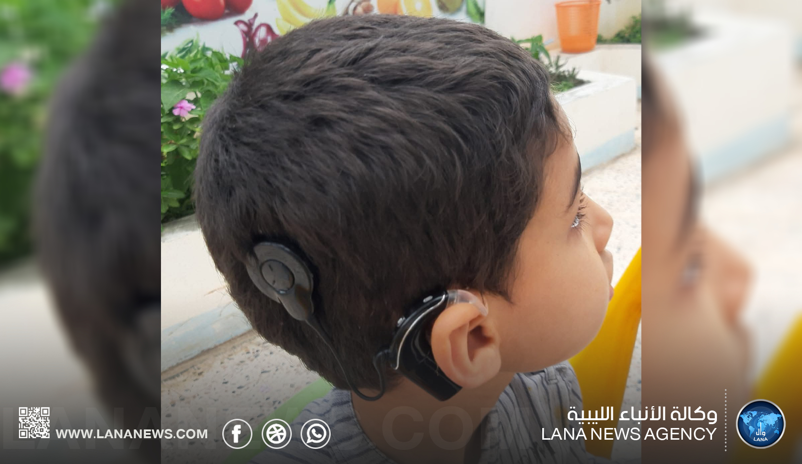 زراعة القوقعة في ليبيا.. خبرات محلية تعزز فرص التأهيل والدمج للأطفال